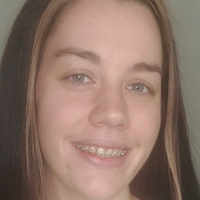bracefacefree Çıplak