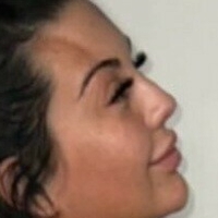 Chlofans Çıplak