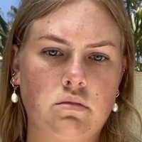 Chynnaclair Çıplak
