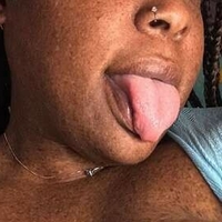 freckledfantasy5 Çıplak