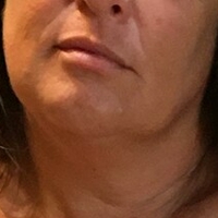 Lady Lara Çıplak