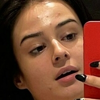 Lauraysergii Çıplak