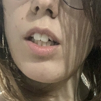 lolitakiwis Çıplak