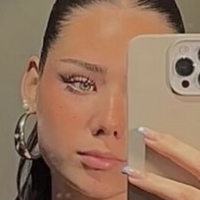 Mthlara Çıplak