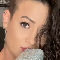 rocking_alopecia Çıplak
