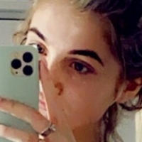 tiexox2 Çıplak