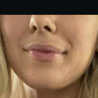 Wettmelons Çıplak
