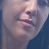 Wirtoly Çıplak